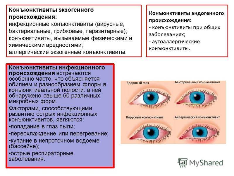 Воспалительные заболевания глаз - лечение, причины, симптомы