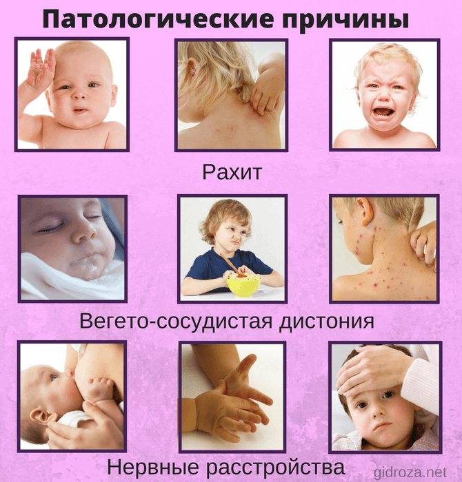 Почему потеет сильно голова и шея. Сильная потливость у детей причины. Потеет голова у грудничка. У ребёнка потеет голова причины. Потеет голова у ребенка во сне.