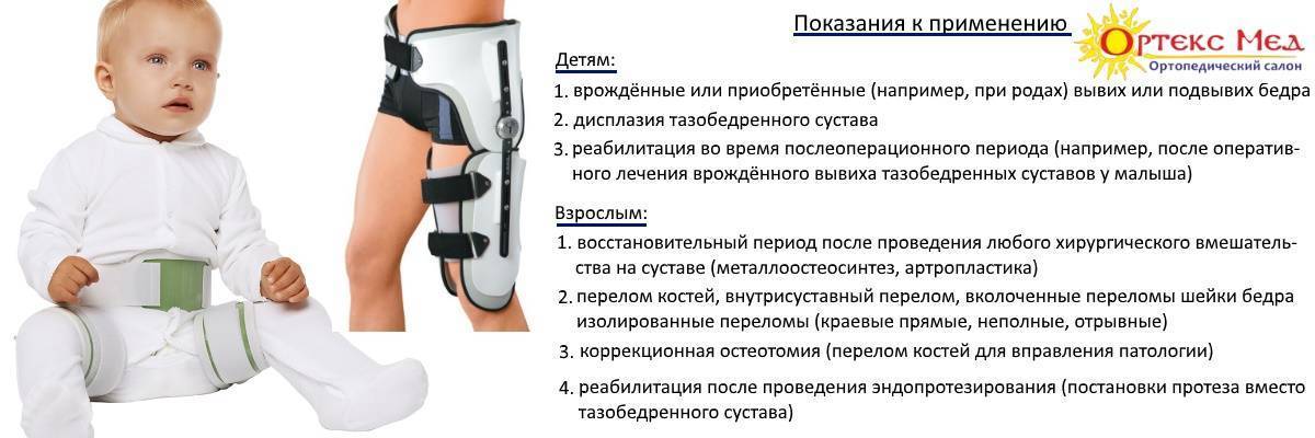 Презентация дисплазия тазобедренных суставов