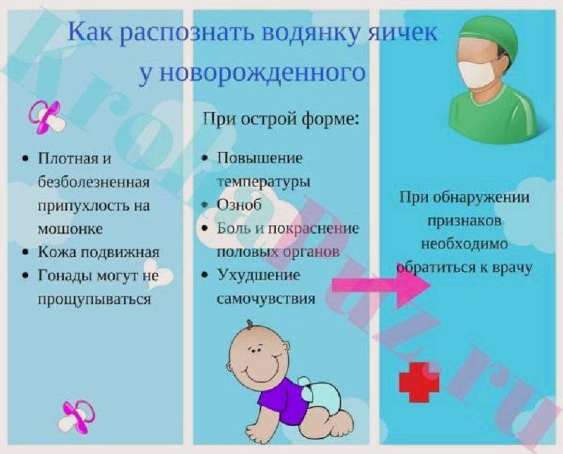 Водянка яичек у новорожденных мальчиков: причины и лечение