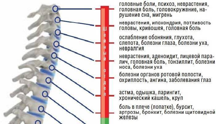 Шейный остеохондроз симптомы у женщин после 60. Остеохондроз шейного отдела. Остеохондроз шейного отдела симптомы у женщин. Шейный остеохондроз симптомы. Шейный остеохондроз симптомы у женщин.