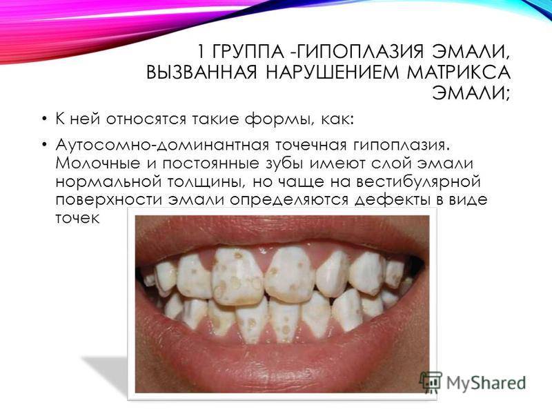 Как убрать черный налет на зубах, причины, профилактика - блог seline