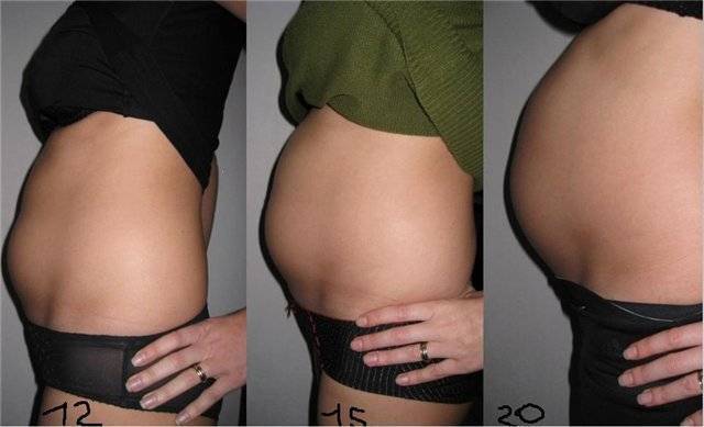 Тянет живот на 12 неделе. Живот при беременности 12 недель. 12 Недель беременности размер живота. Живот 12неделя беременнсоти.