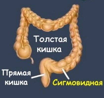 Воспаление кишечника - симптомы, лечение, диагностика и профилактика