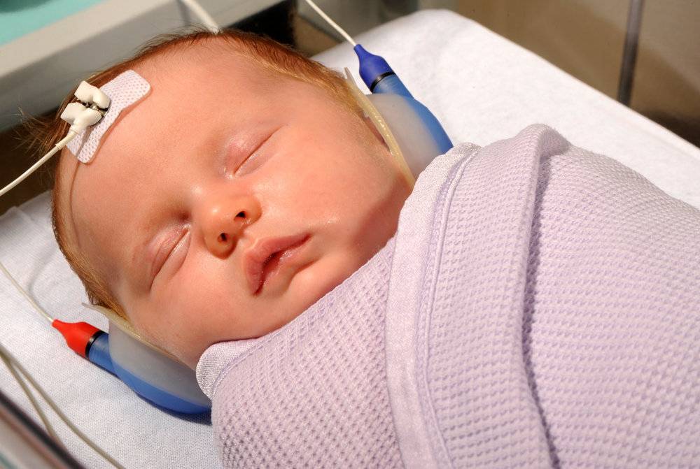 Как в роддоме проверяют слух у новорожденного