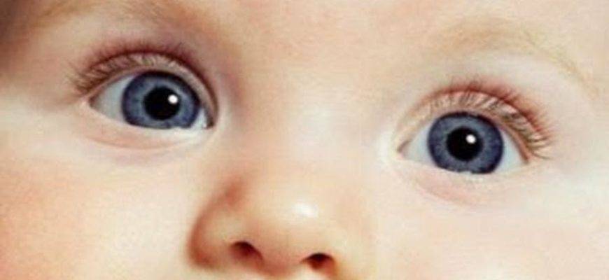 Диагноз разный размер зрачков. анизокория: почему у младенцев бывают разные зрачки