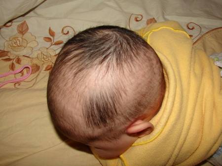 У младенца плохие волоски: что делать, если волосики растут медленно