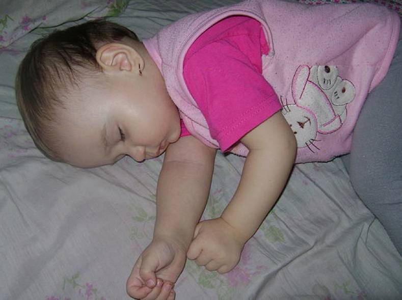 Ребенок сильно потеет во сне: причины