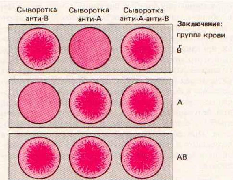 Определение резус-фактора плода в крови матери молекулярно-генетическим методом