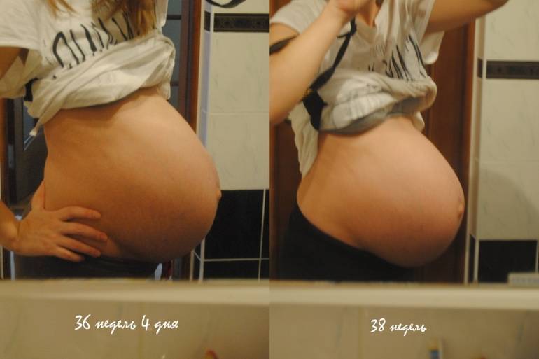 37 неделя беременности фото живота