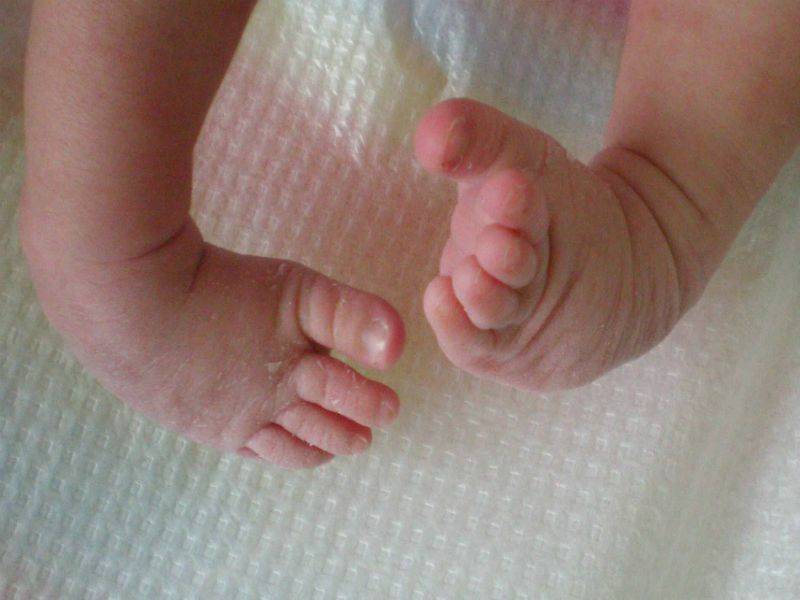 Почему облазит кожа на пальцах ног у ребенка
