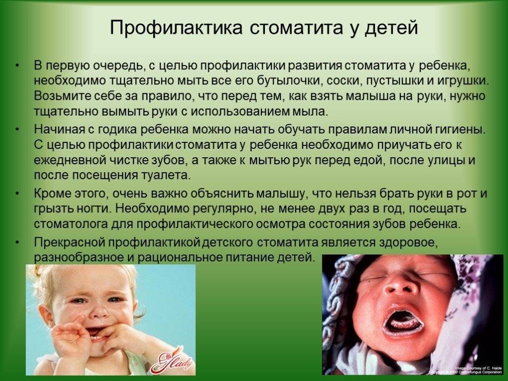 Лечение стоматита у детей: симптомы, виды и профилактика