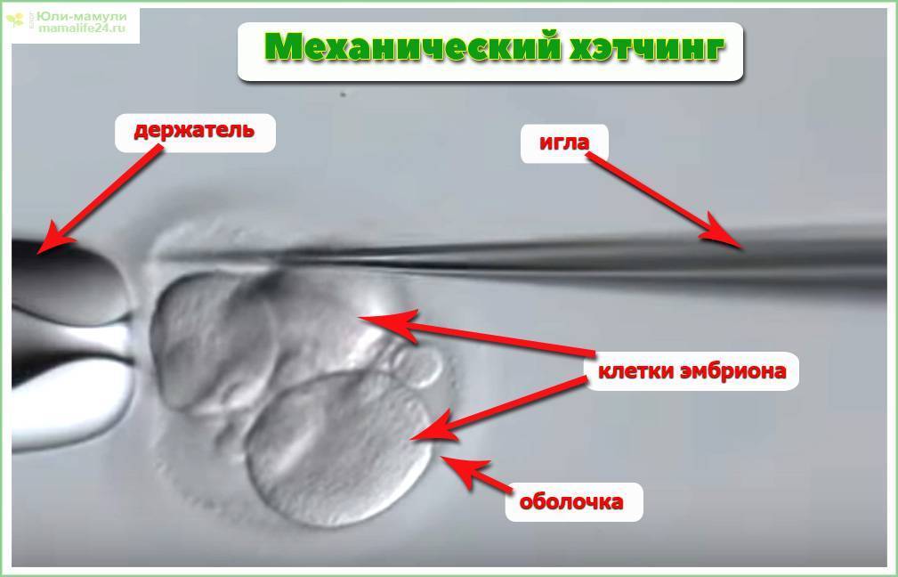Противопоказания к эко: какие есть?