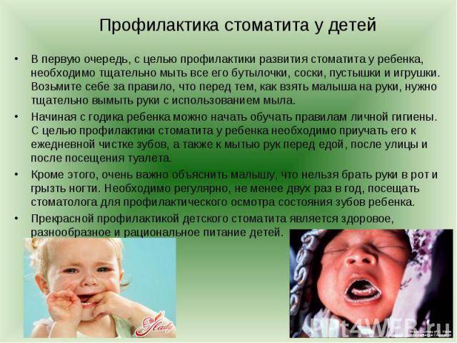 Стоматит у годовалого ребенка и малыша до года: лечение и симптомы с фото