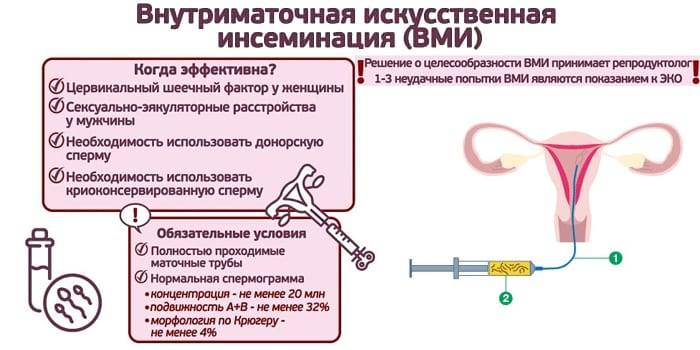 Инсеминация: процент успеха