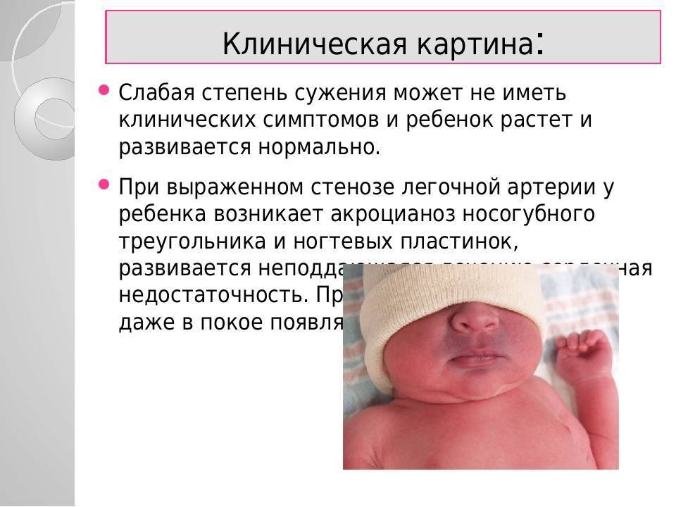 Впс у детей: причины, симптомы, диагностика и лечение