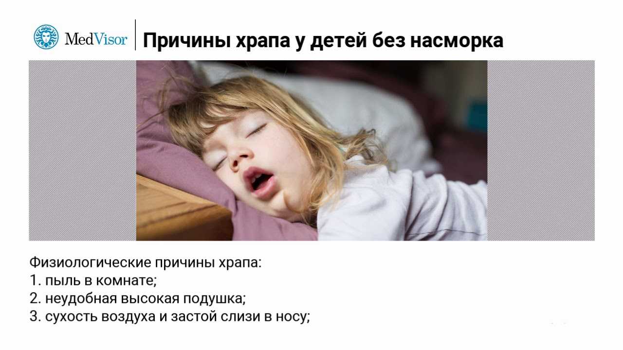 Ребенок храпит во сне - причины и лечение