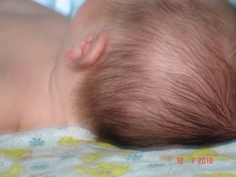 Почему волосы у ребенка растут плохо — возможные причины