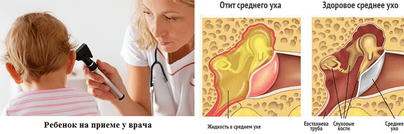 Боль в ухе – не всегда первичный симптом!