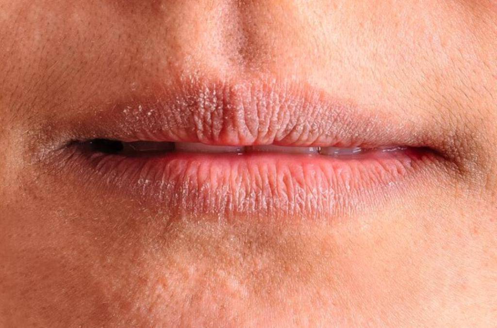 Воспаление слизистой оболочки полости рта: причины и лечение