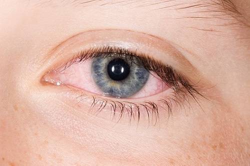 Вирусный конъюнктивит глаз: лечение, причины и симптомы, признаки заболевания