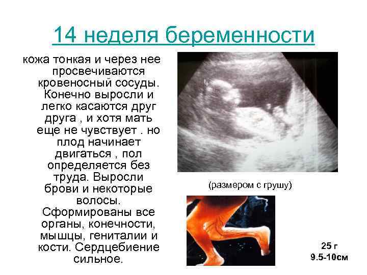 Конец 14 недели. 14 Недель размер ребенка. 12-14 Недель беременности. Плод на 14 неделе беременности. 13 14 Недель беременности размер плода.