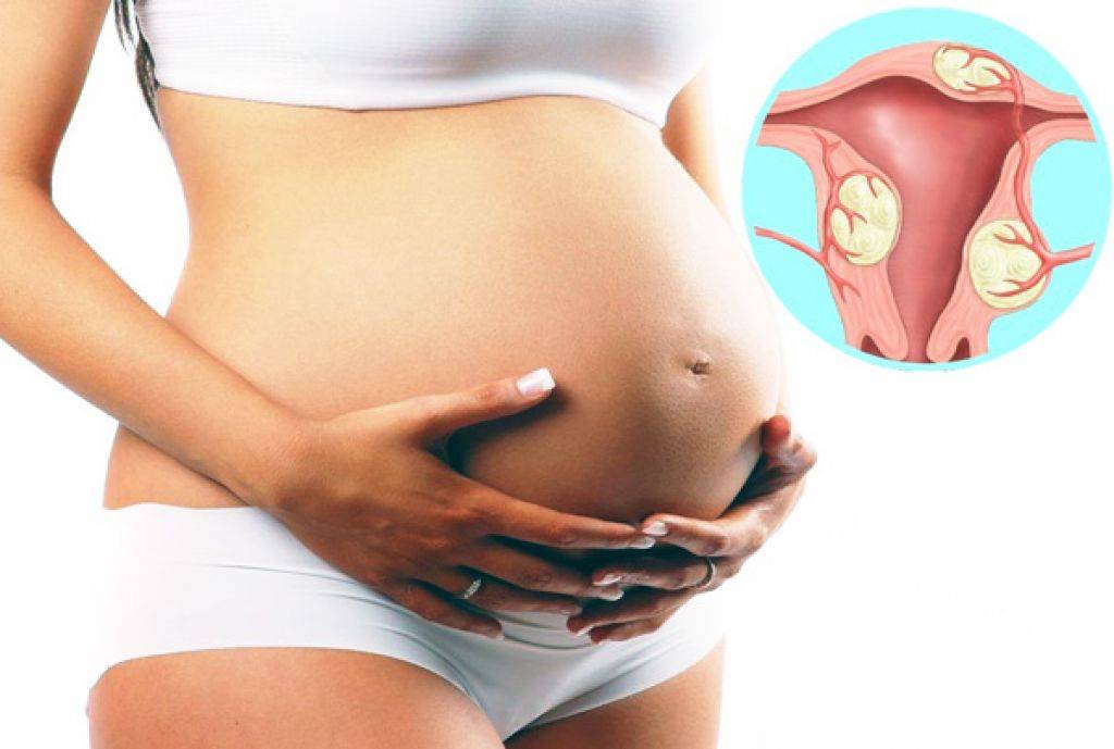 Многоплодие — что ждет будущую маму — патологии