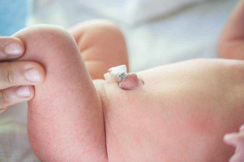 Пупок у новорождённого торчит: основные причины и эффективные методы борьбы