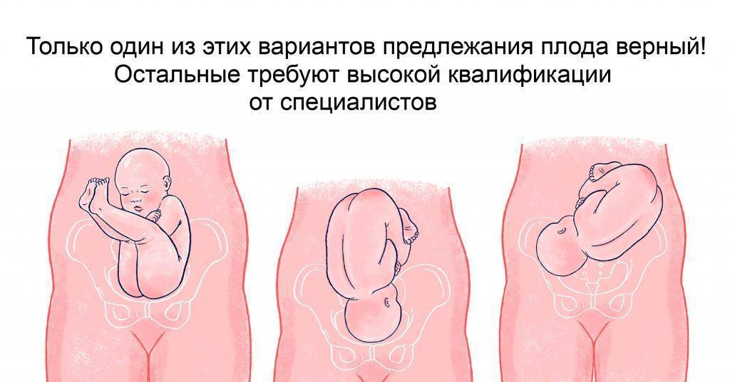 Когда ребенок переворачивается вниз головой в животе во время беременности