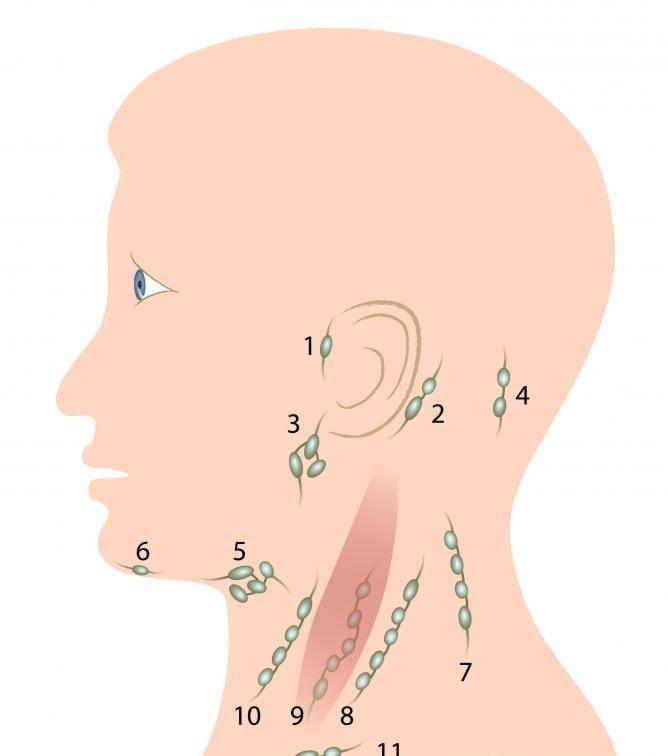 Лимфоузлы на шее расположение схема у взрослых что делать воспалились