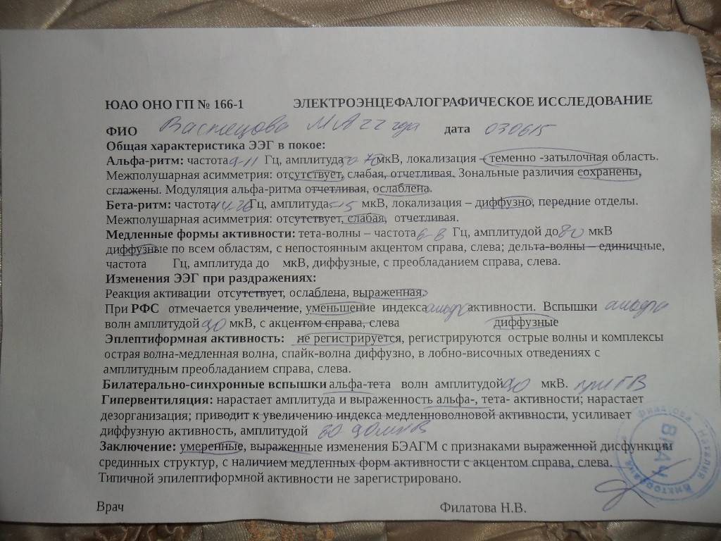 Диагностика заболеваний по ээг