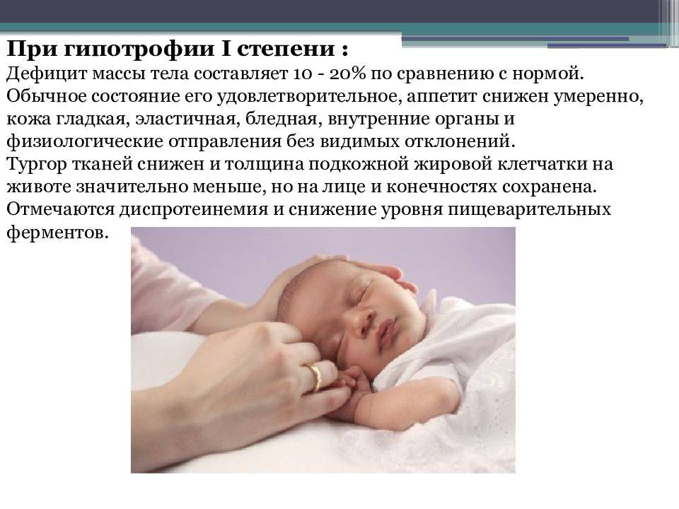Гипотрофия у детей раннего возраста и новорожденных: факторы риска, симптомы и лечение