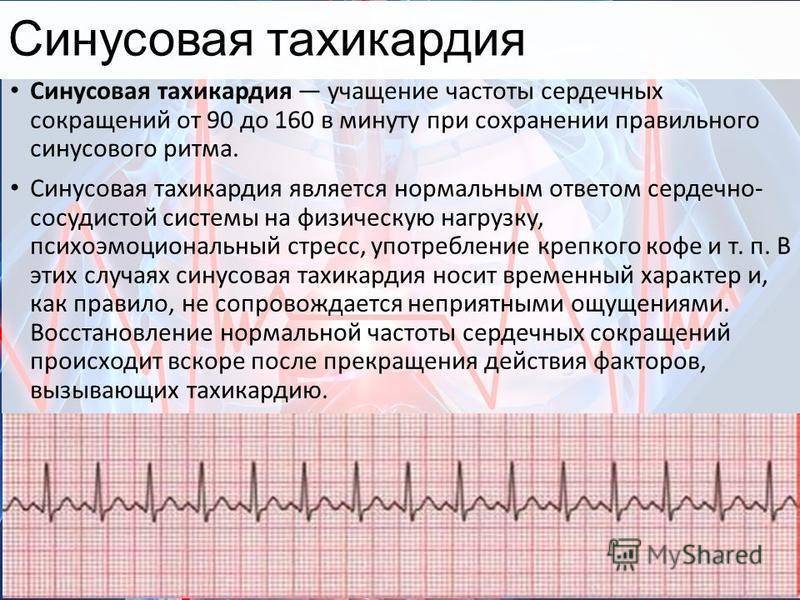 Синусовая тахикардия карта вызова скорой