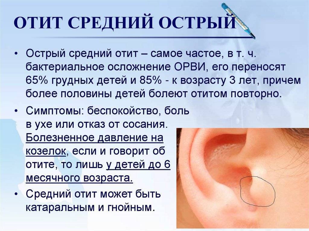 Тубоотит — воспалительное поражение среднего уха и слуховой трубы