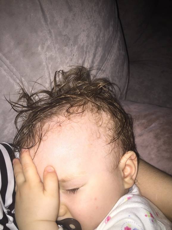 Потеет голова во время сна у ребенка или взрослого, причины мокрой подушки утром