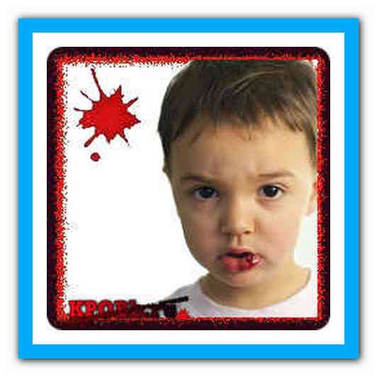 Ребенок разбил губу и она опухла изнутри: что делать при ушибе с отеком, чем обработать рану?