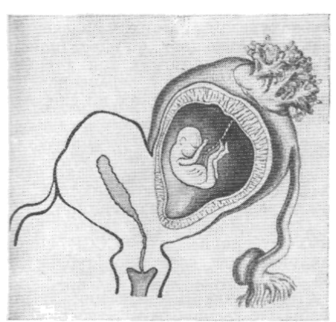 Беременность при опущении матки: вынашивание плода, последствия, степени опущения
