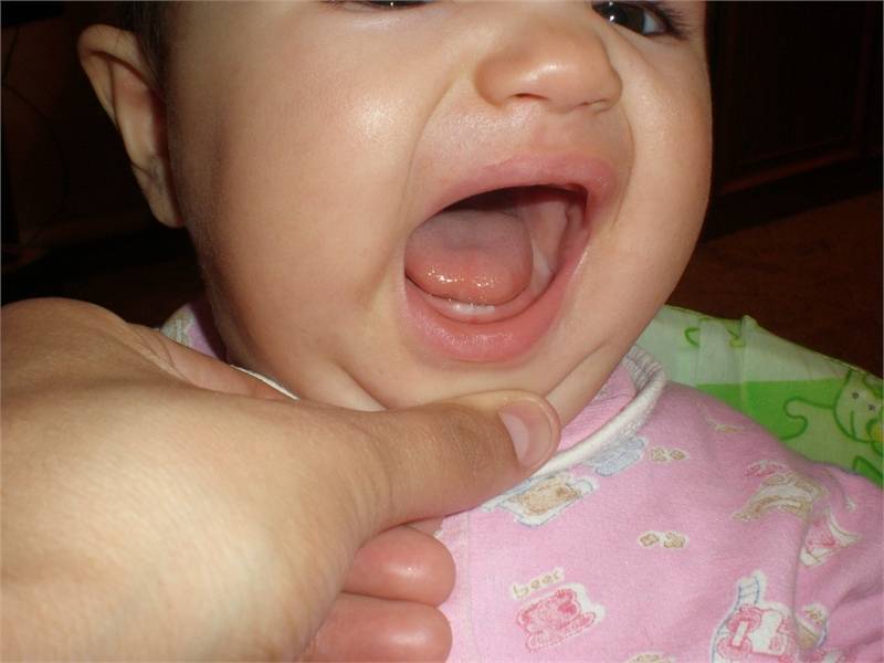 Прорезывание зубов у ребенка: симптоматика