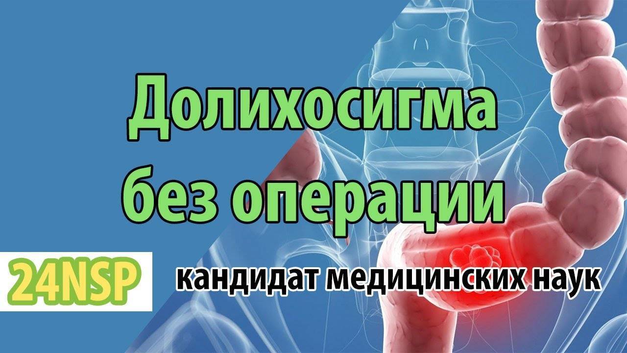 Долихосигма у детей фото