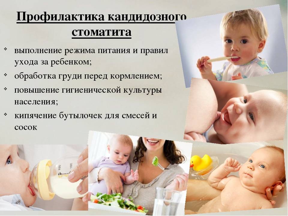 Лечение вирусного, гнойного, афтозного и острого стоматита у детей. лечение стоматита у маленьких детей в цэлт