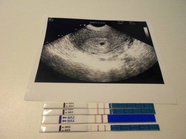Узи на 1, 2, 3 неделе беременности; покажет ли узи, фото