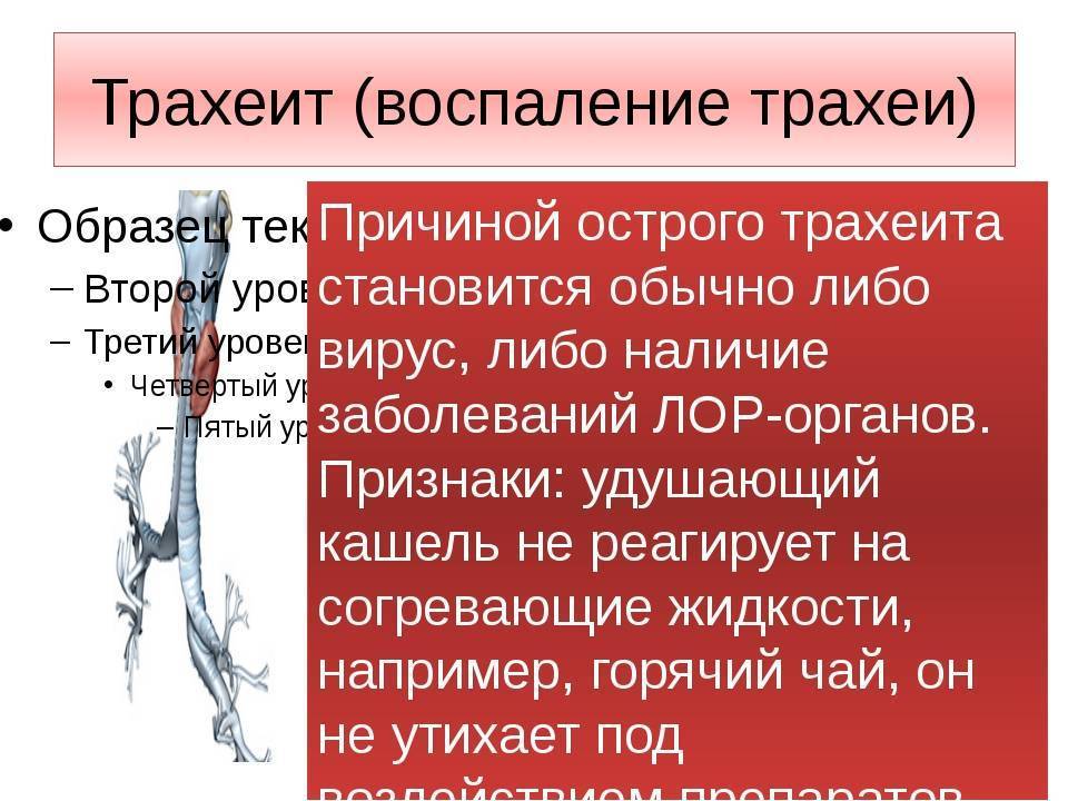 Острый трахеит: симптомы и лечение хронического трахеита